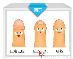 做包皮手術(shù)最好的方法是什么?九江醫(yī)大醫(yī)院