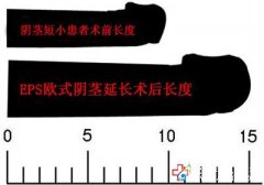 為什么陰莖那么短？應(yīng)該