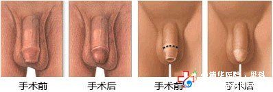 九江做包皮哪家醫(yī)院好 九江做包皮哪家醫(yī)院好