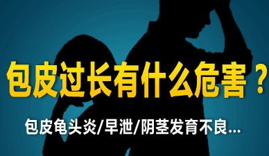 九江市做包皮切除術(shù)多少錢